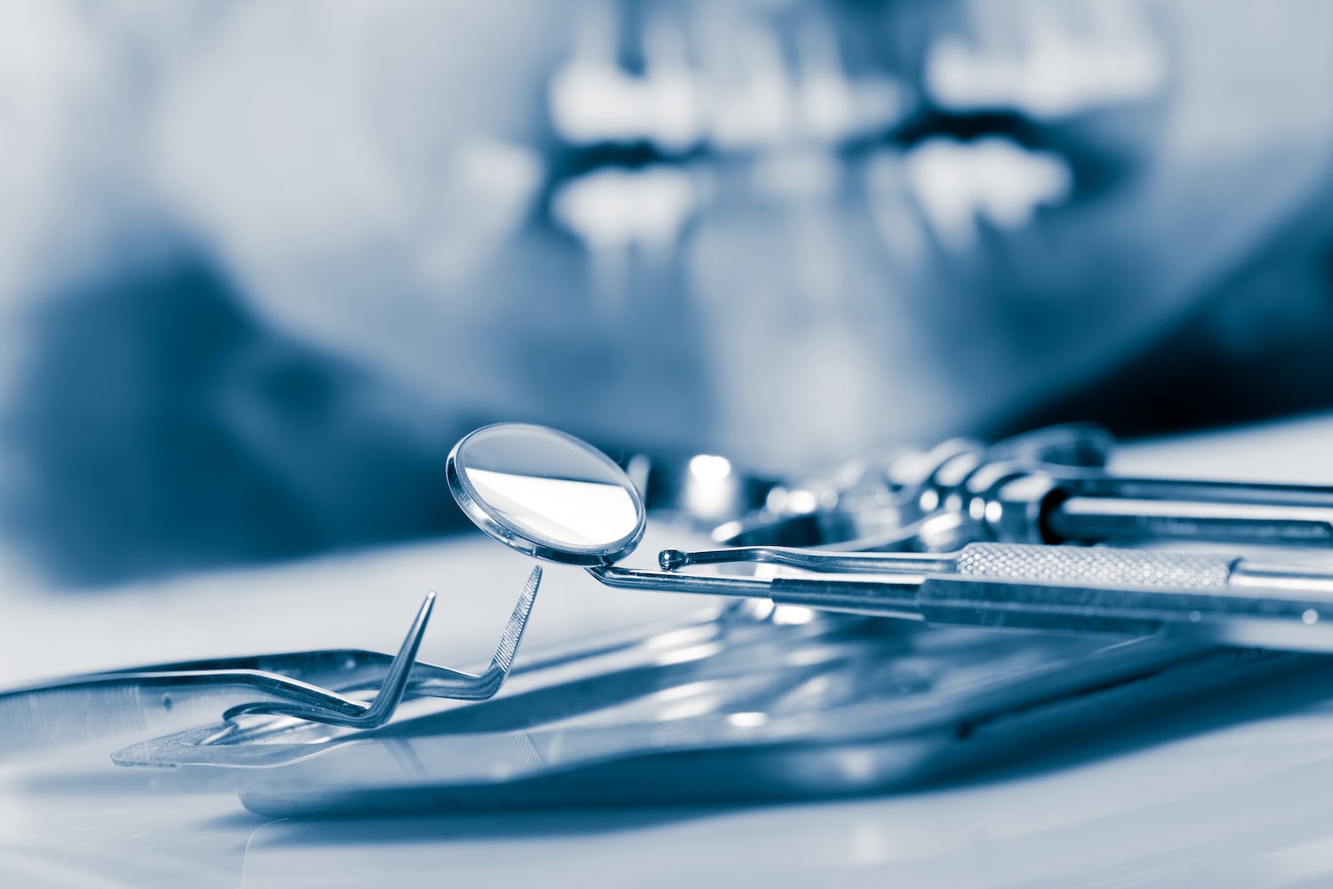 歯内療法　トラブル