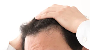 薄毛は何が原因で起こる？