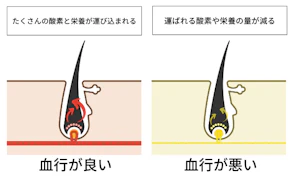 4. 血行不良