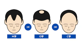 男性の抜け毛の特徴