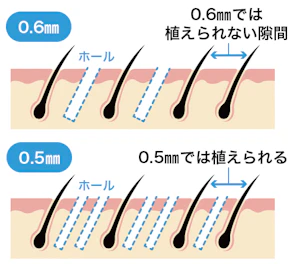 髪の密度が高くなる