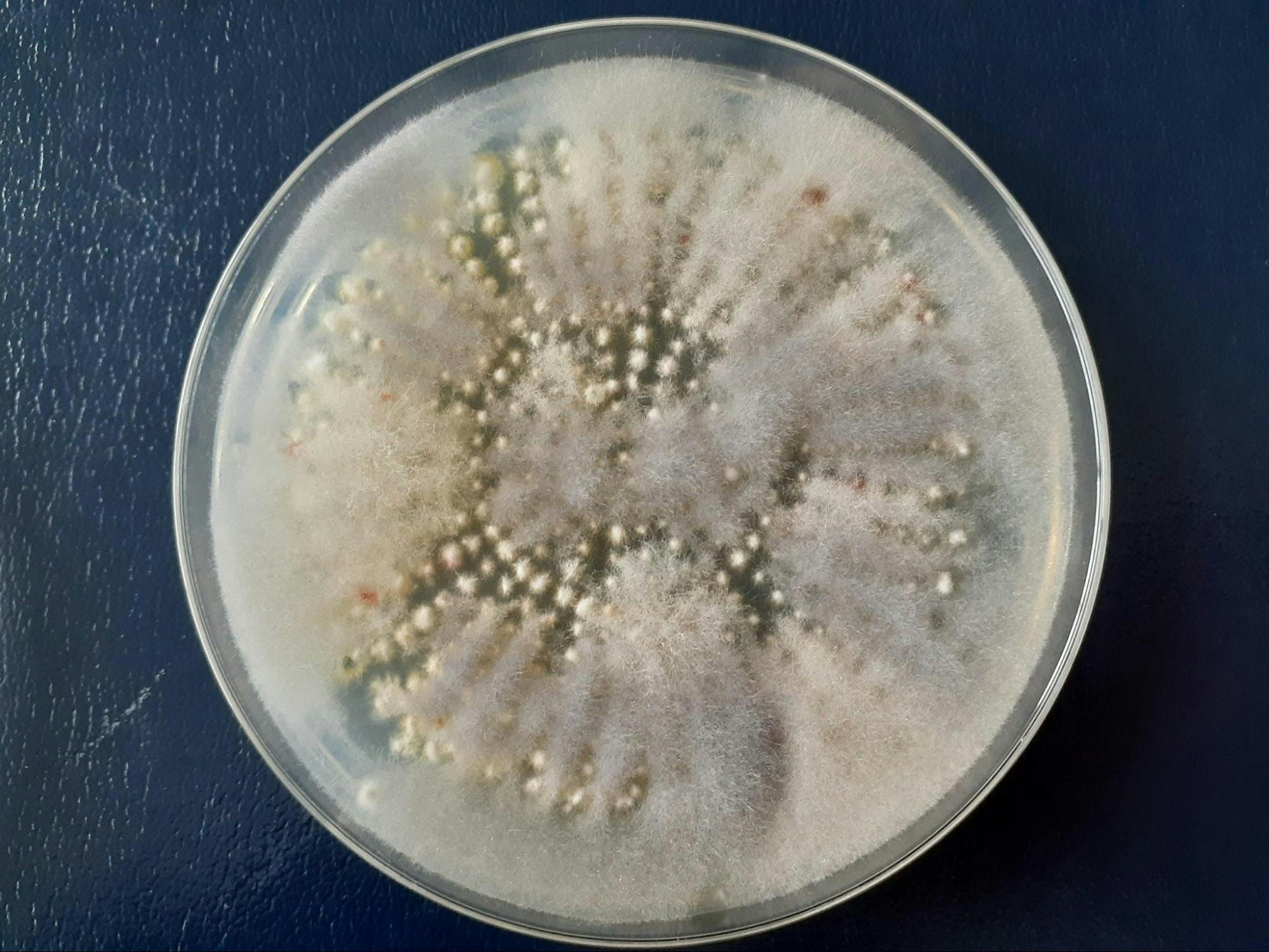 除菌前。無数のコロニーが確認できる。