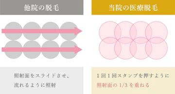 万全の打ち漏れ対策