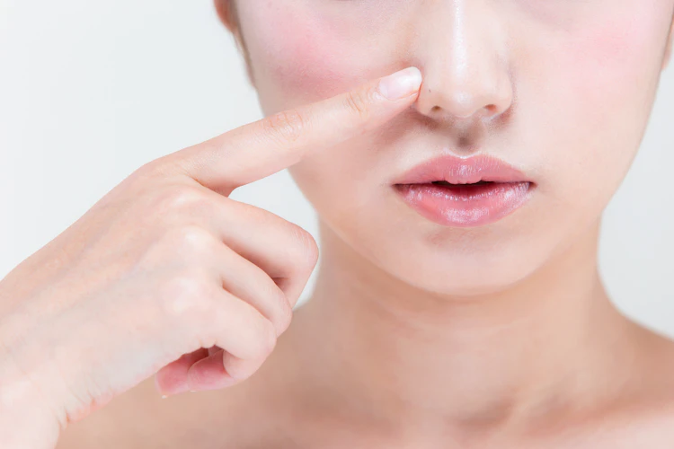 【鼻ニキビとは？】原因と予防法、キレイに治すコツを解説