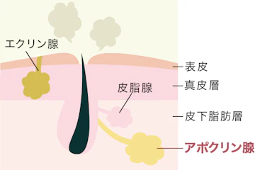 ワキガ(腋臭症)の原因と特徴