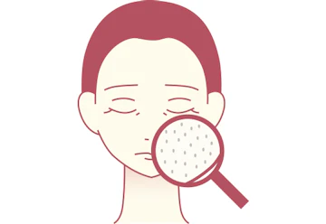 たるみ毛穴