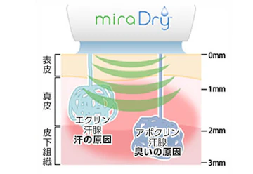 ミラドライの仕組み