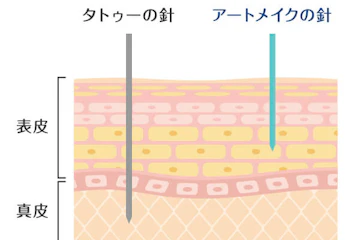 アートメイクは入れ墨とは違い医療行為です