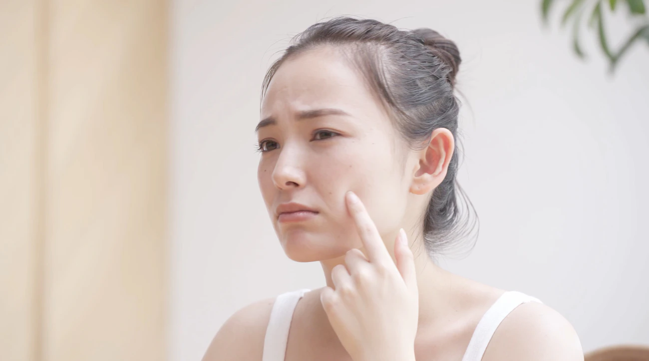 顔にできるシミの原因と治療方法
