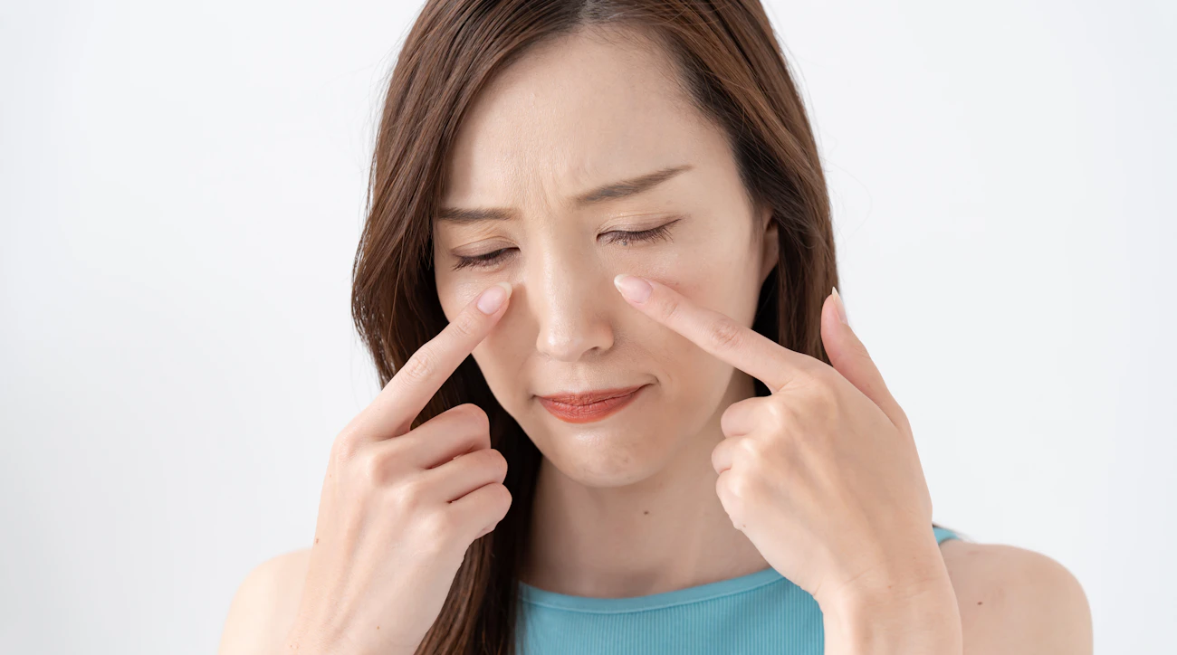 【目の下のシミ】原因と対策、早く消すための美容皮膚科の治療法を解説
