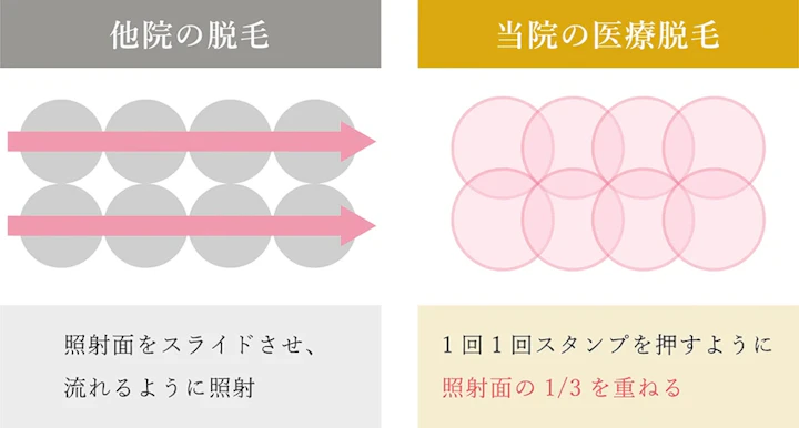 万全な打ち漏れ対策と技術の研鑽