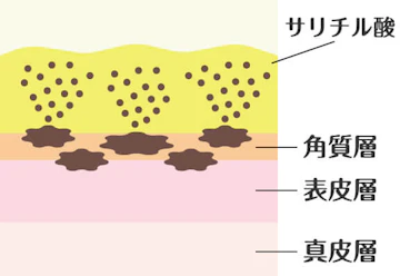 サリチル酸マクロゴール