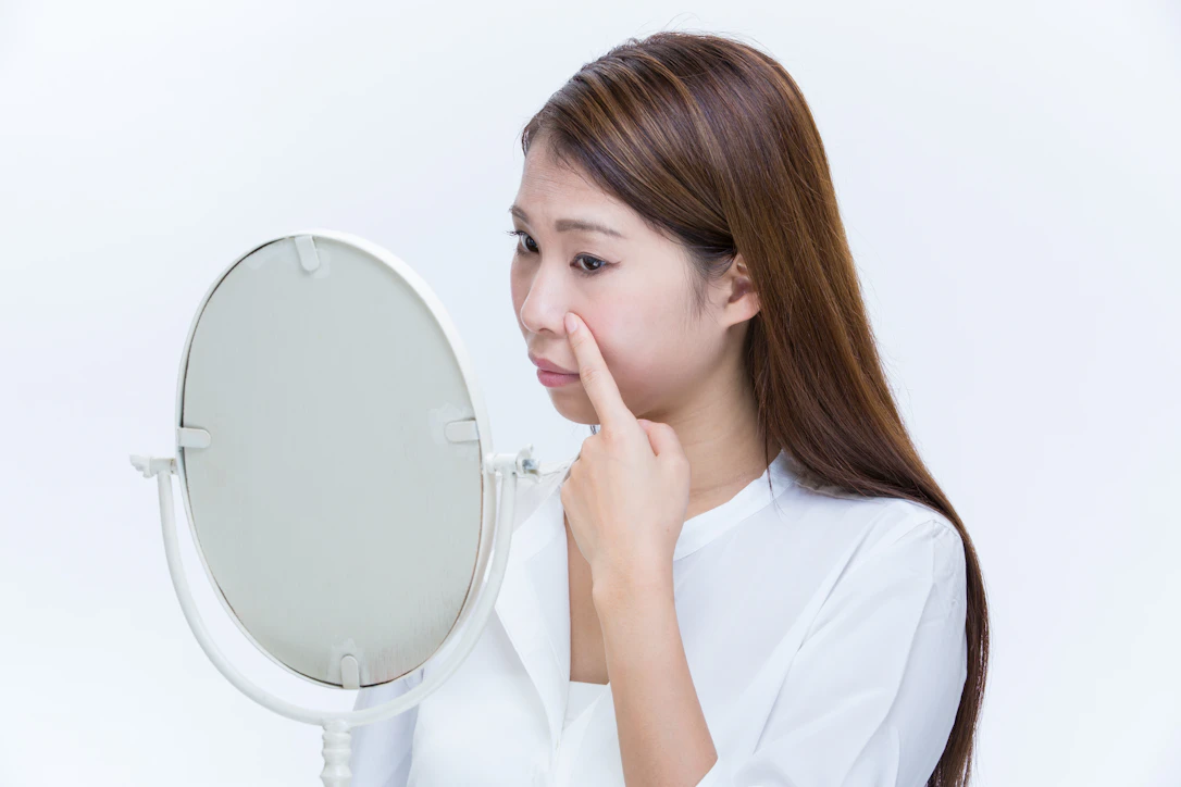 鼻にできた痛いニキビの治し方は？できる原因と予防法も解説
