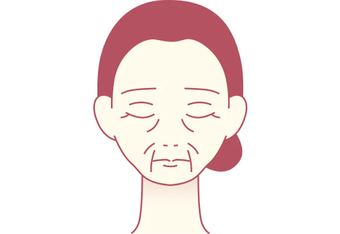 たるみじわ