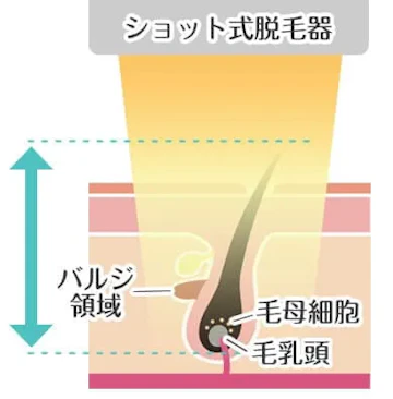 熱破壊式（ショット式）のメカニズム