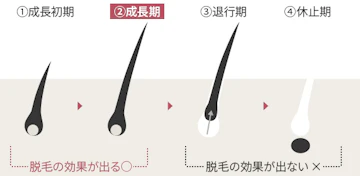脱毛効果があるのは「成長期」の毛だけ