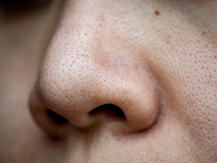鼻の肌