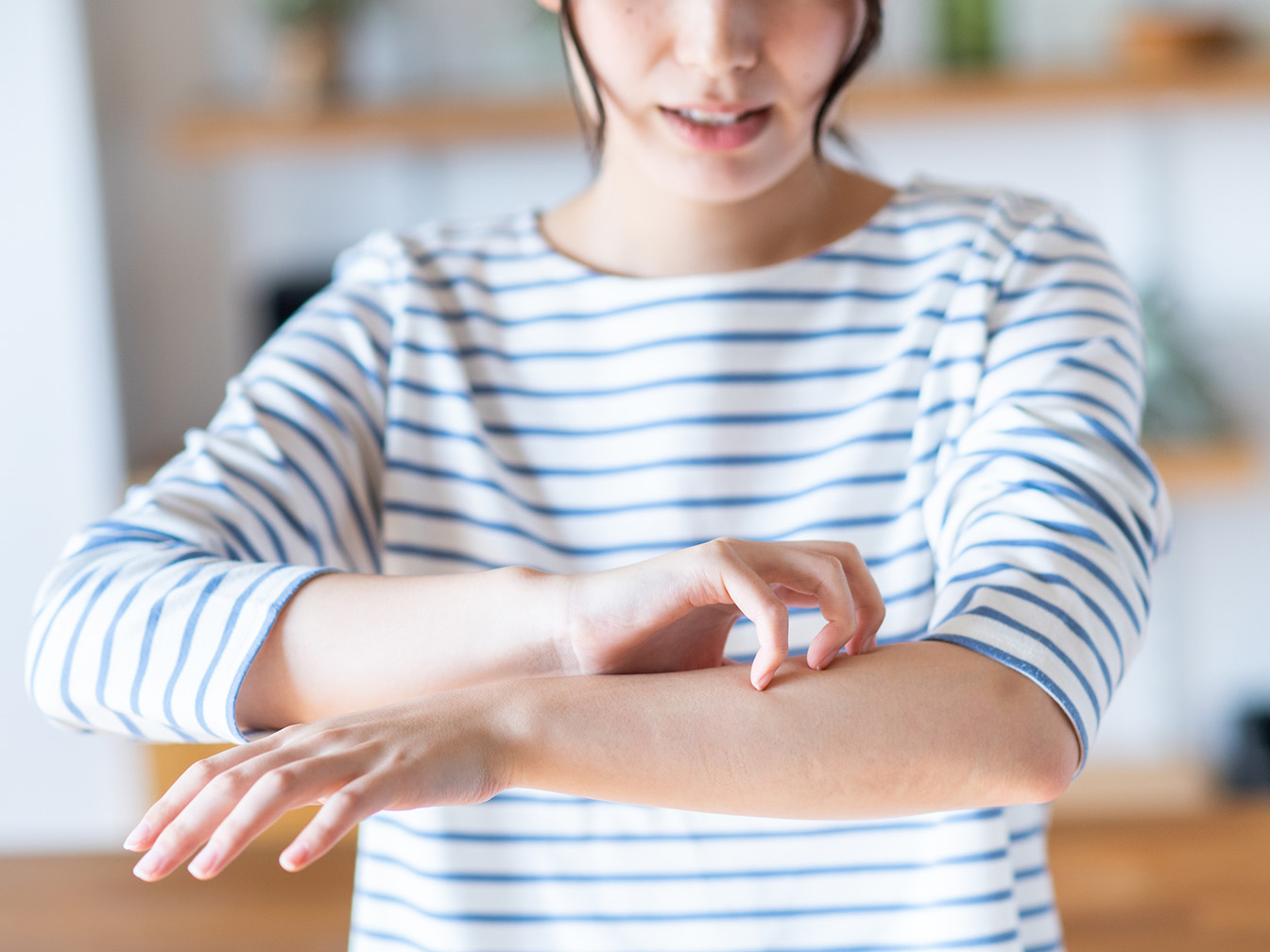 酢酸菌はアトピー性皮膚炎を改善