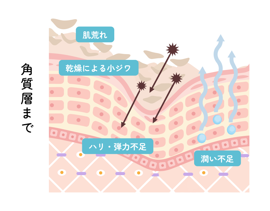 角質層に起こる肌荒れや乾燥小ジワなどの肌トラブルを示した断面図