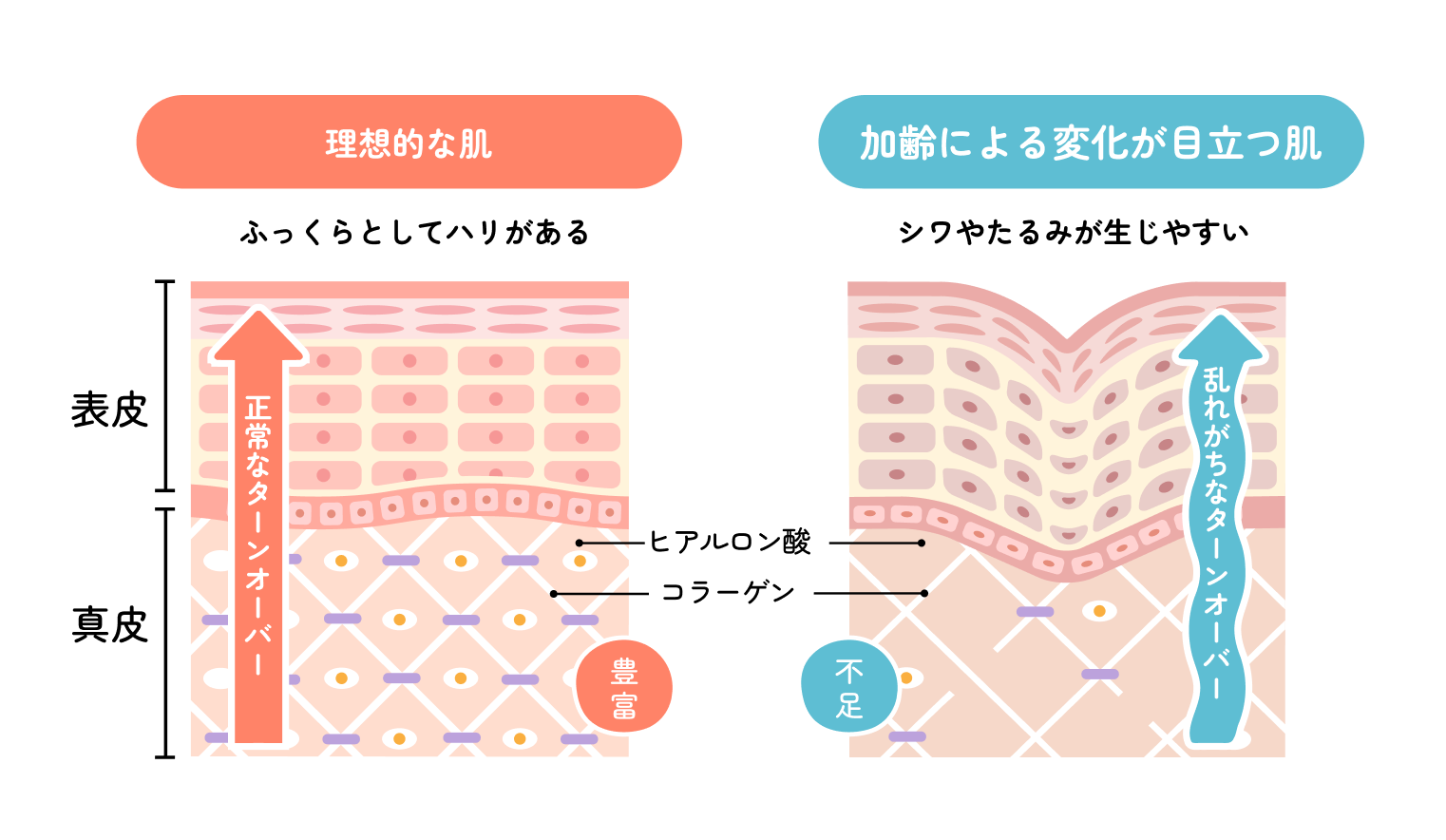 理想的な肌と加齢による変化が目立つ肌を比較した断面図