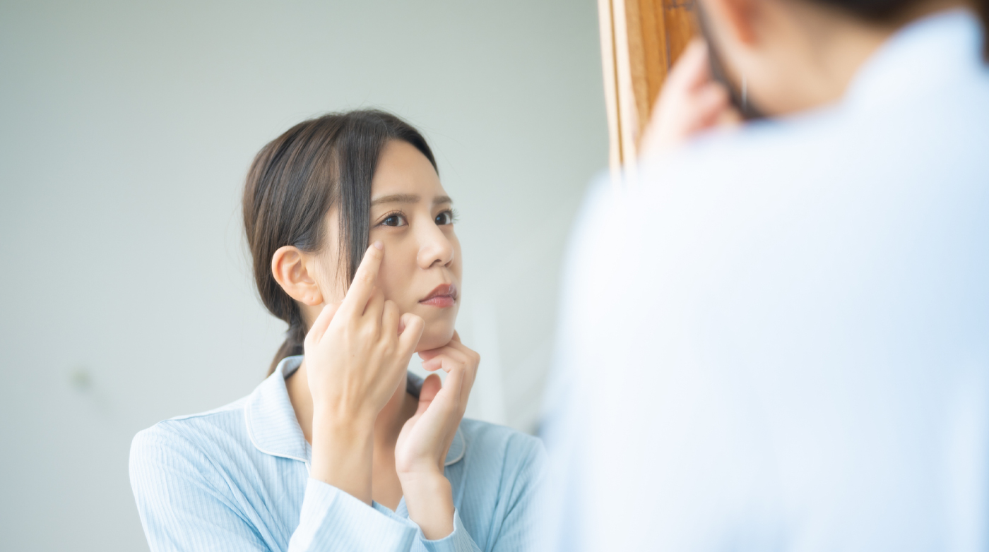 肌とストレスの関係は？肌荒れやニキビの原因と対策を紹介