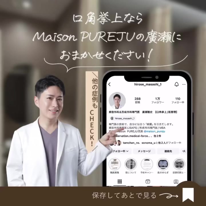 口角挙上で笑いにくさを改善しより魅力的な笑顔になった症例 画像4
