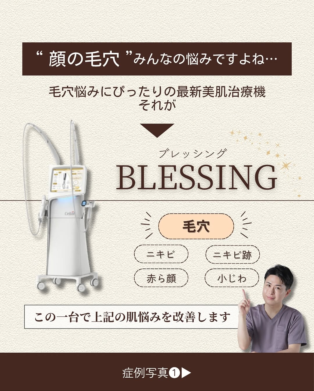 ブレッシングで頑固な毛穴をニードルRFと薬剤の相乗効果で改善した症例 画像2