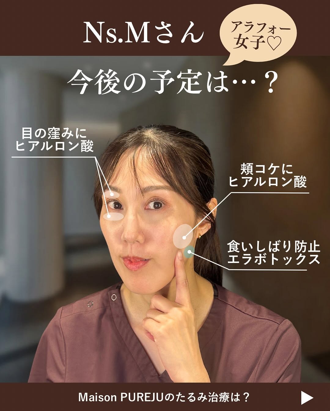 スタッフのたるみ治療年間計画｜アラサー・アラフォー看護師のリアルな施術スケジュール 画像5