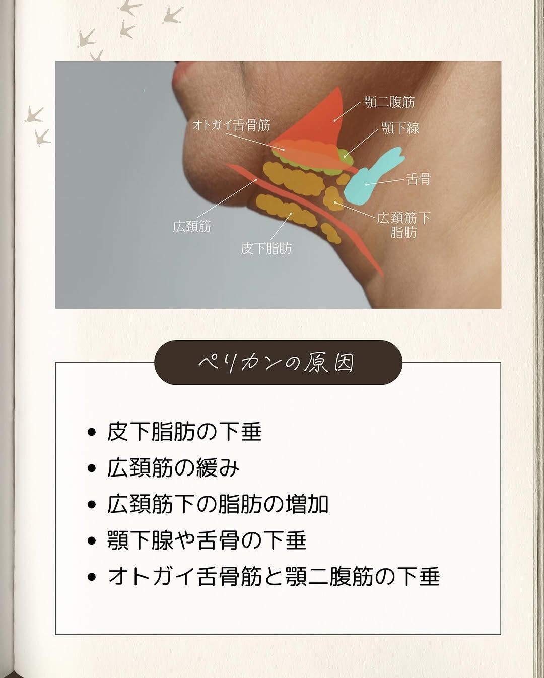 ペリカンリフトとは｜あご下・二重顎のたるみを複合的に改善する手術の仕組みと適応 画像3