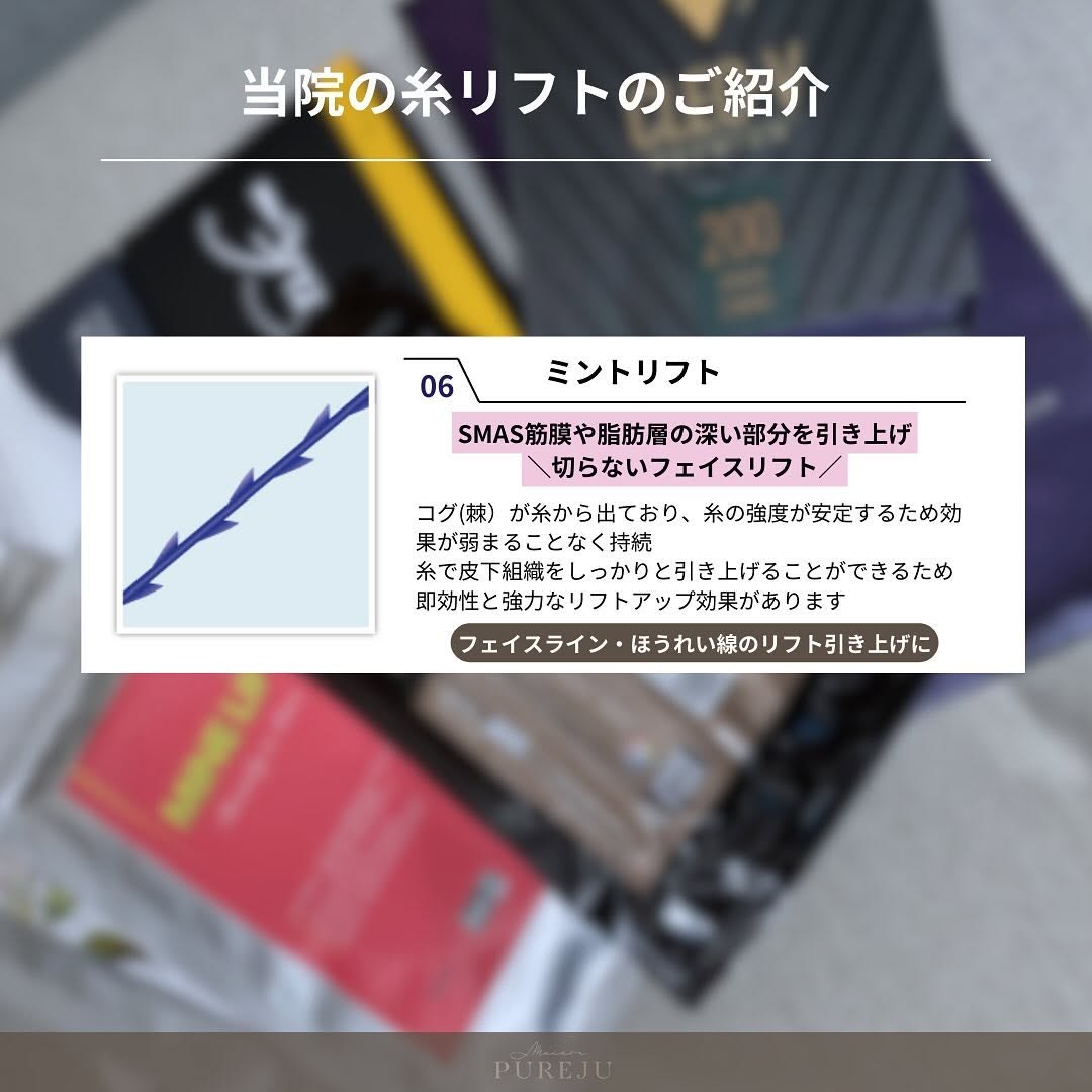 糸リフト7種類を徹底解説②｜スパイラル・ロイヤル・テスリフト・ミントリフトなど各糸の特徴と使い分け 画像5