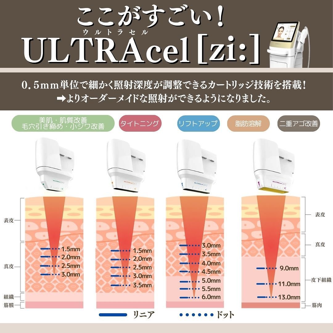 Maison PUREJUのハイフ（HIFU）｜ULTRAcel[zi:]で行うオーダーメイドたるみ治療の3つのこだわり 画像3