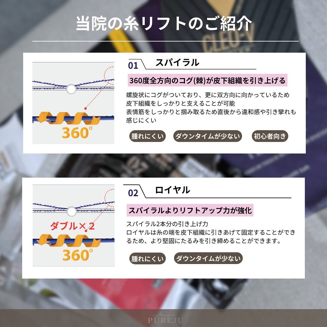 糸リフト7種類を徹底解説②｜スパイラル・ロイヤル・テスリフト・ミントリフトなど各糸の特徴と使い分け 画像2