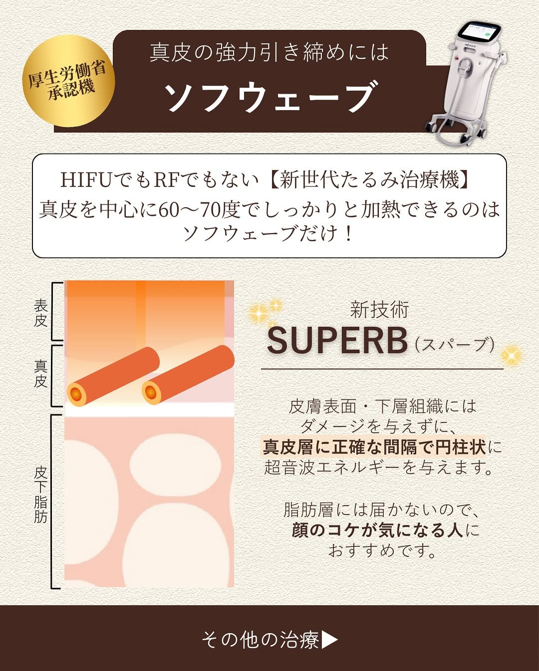 皮膚たるみに特化した治療3選｜ソフウェーブ・ショートスレッド・ニードルRFで真皮層から引き締め 画像3
