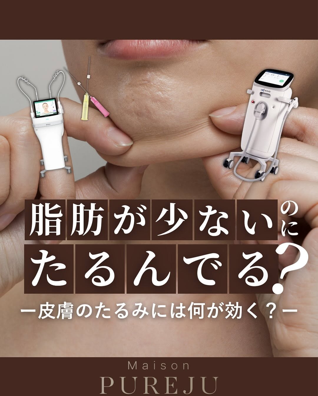 皮膚たるみに特化した治療3選｜ソフウェーブ・ショートスレッド・ニードルRFで真皮層から引き締め