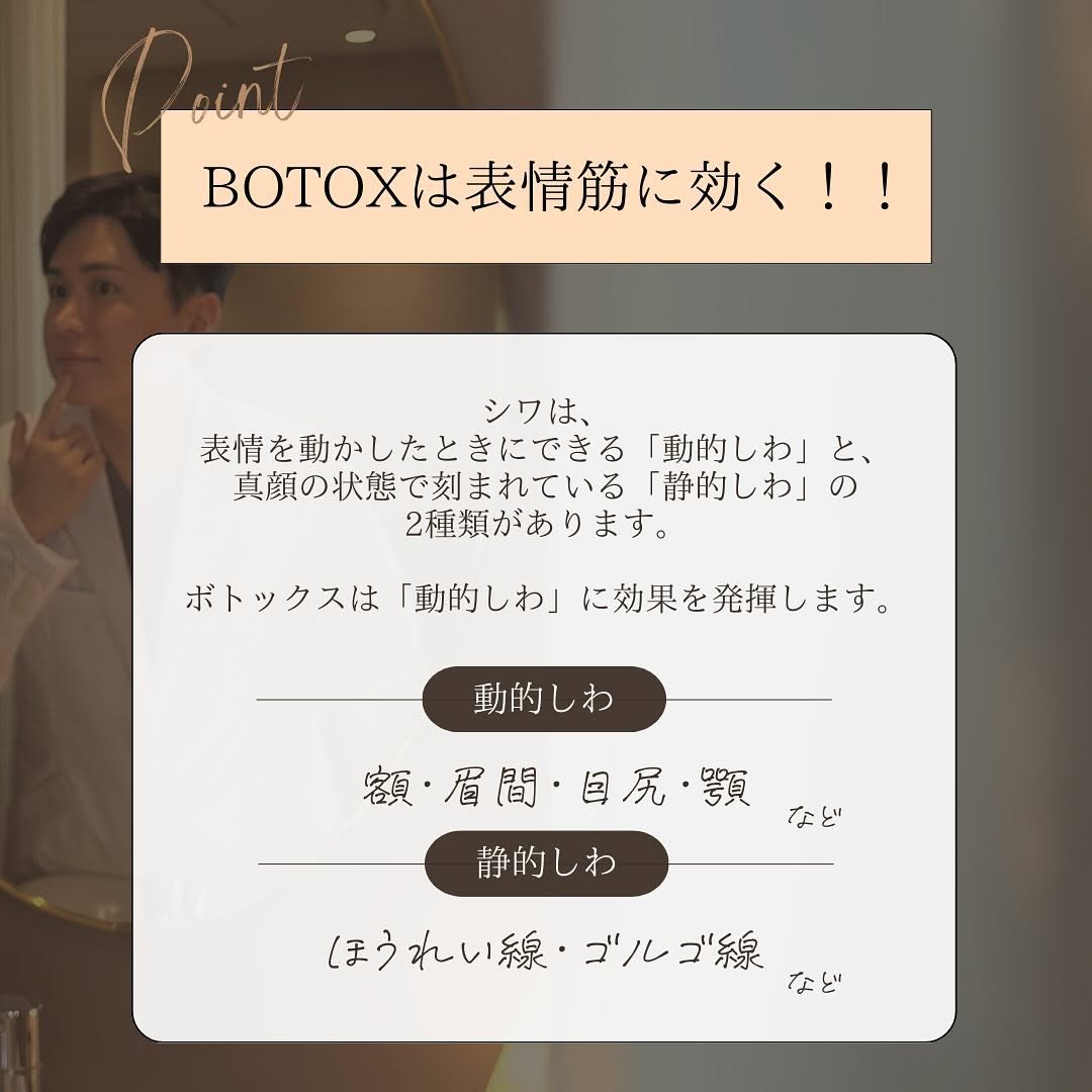 ボトックスでできること｜動的シワ・小顔・汗止め・リフトアップまで用途と効果をQ&Aで解説 画像3
