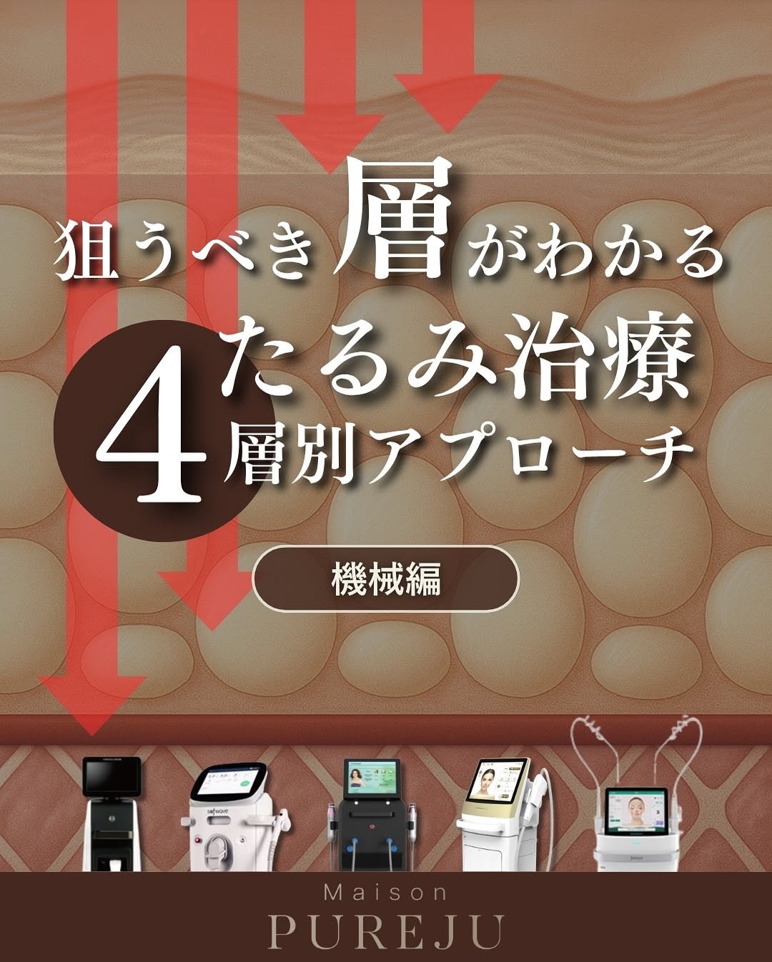 たるみ治療4層別アプローチ（機械編）｜SMAS・脂肪層・真皮深層・真皮浅層ごとに最適な機器を解説