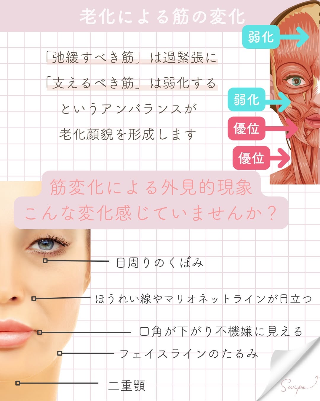 顔の筋肉の老化がたるみを加速する？メカニズムと対策まとめ 画像4