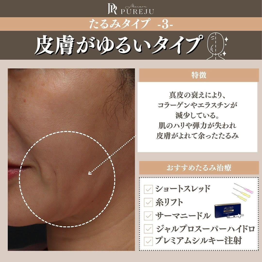 あなたのたるみはどのタイプ？原因3タイプ別おすすめ治療を医師が解説 画像5