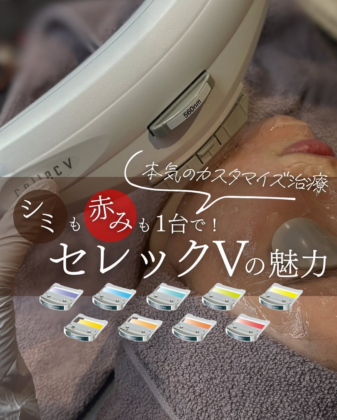 セレックVの9波長カスタマイズ治療｜シミ×赤み×小じわを1台で同時改善できる理由と症例
