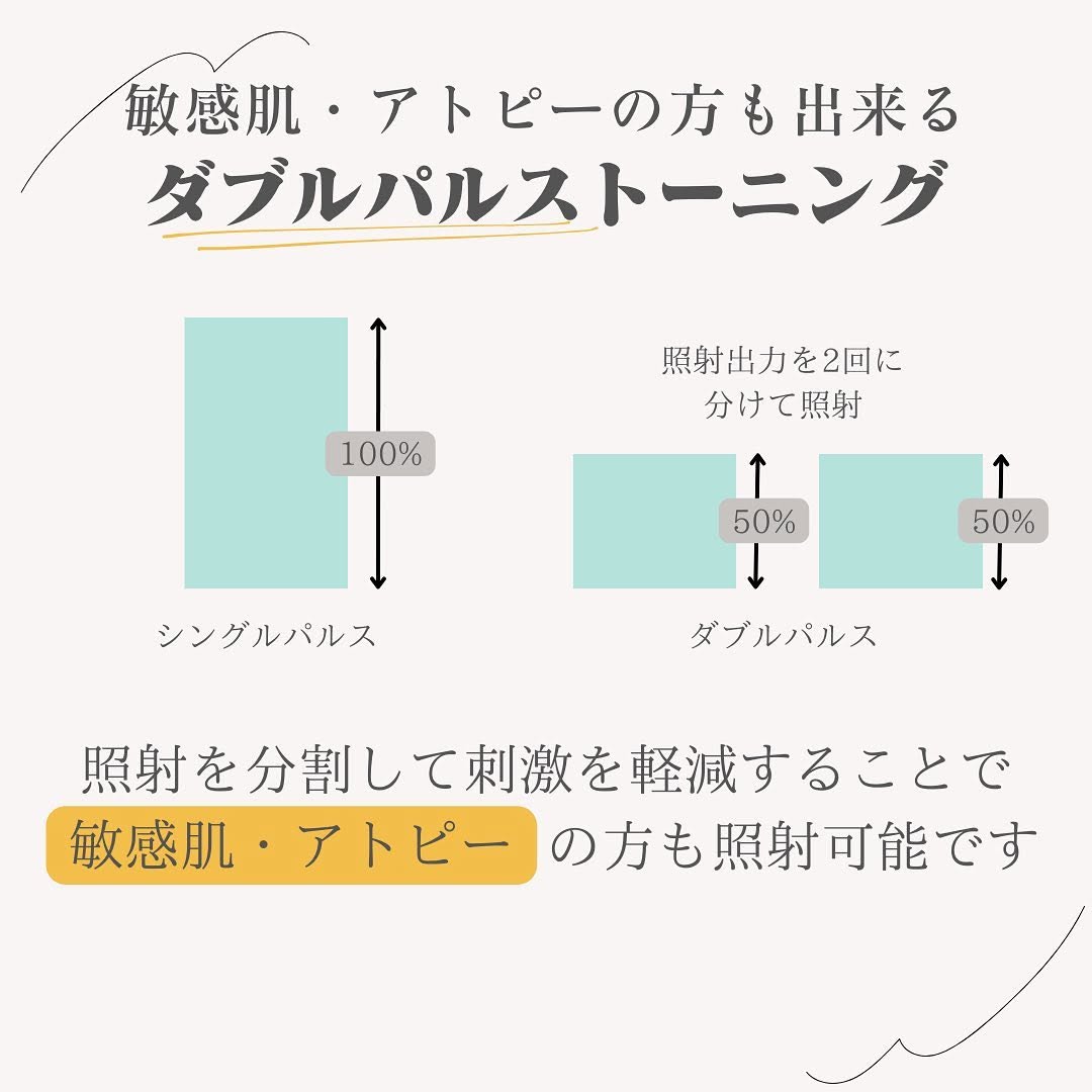 カスタマイズトーニングとは｜肝斑・くすみ・毛穴をダブルパルスで改善するレーザー治療 画像3