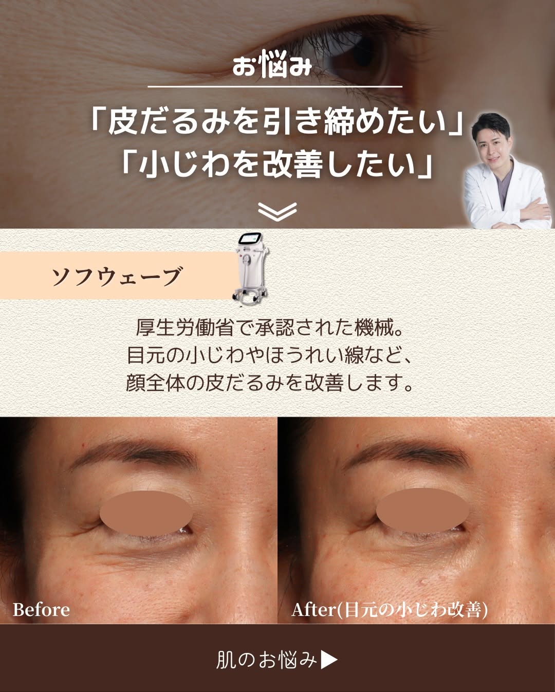 お悩み別おすすめ施術4選｜バランス・たるみ予防・皮だるみ・ツヤ肌それぞれに最適な治療とは 画像4