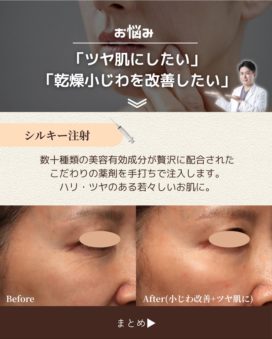お悩み別おすすめ施術4選｜バランス・たるみ予防・皮だるみ・ツヤ肌それぞれに最適な治療とは 画像5