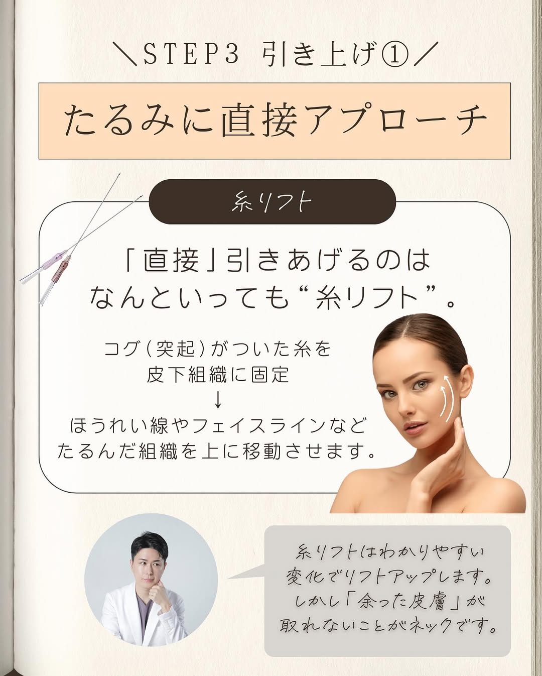 たるみ治療まとめ｜予防・引き締め・引き上げの3STEPと施術の選び方を医師が解説 画像6