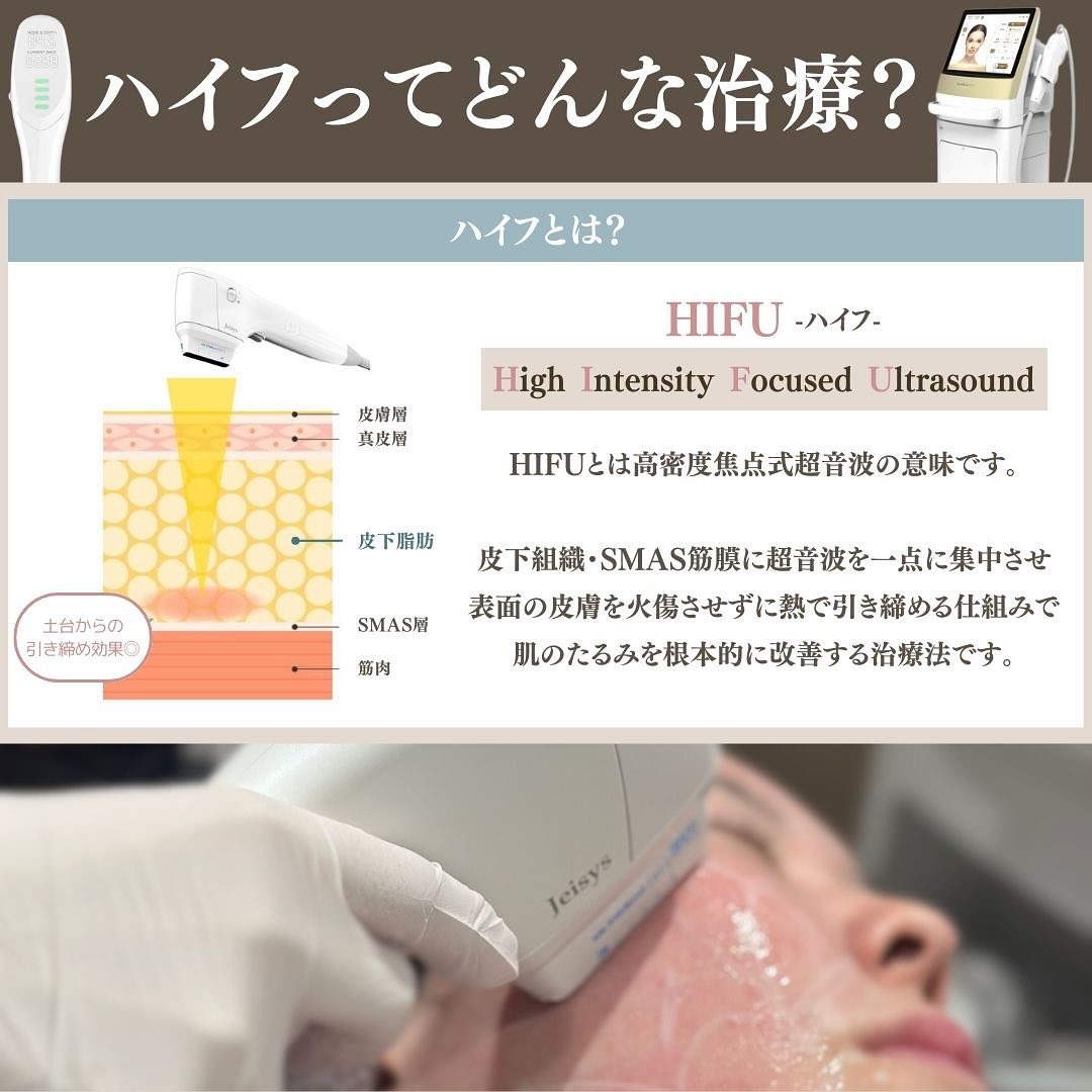 Maison PUREJUのハイフ（HIFU）｜ULTRAcel[zi:]で行うオーダーメイドたるみ治療の3つのこだわり 画像2