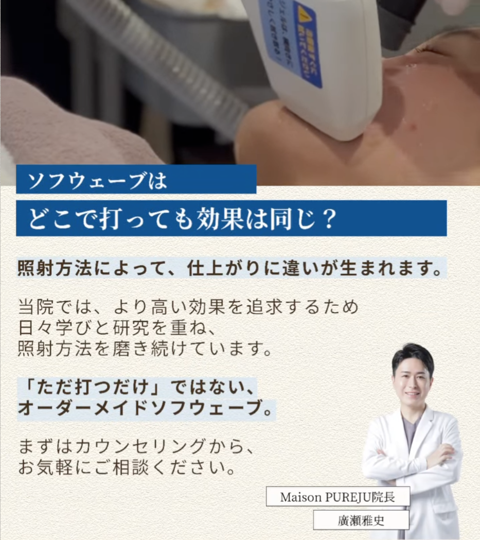 ソフウェーブ×バイオスカルプチャー×ボトックスの複合治療で笑った時の深い表情ジワを改善した症例（1ヶ月後）  画像4