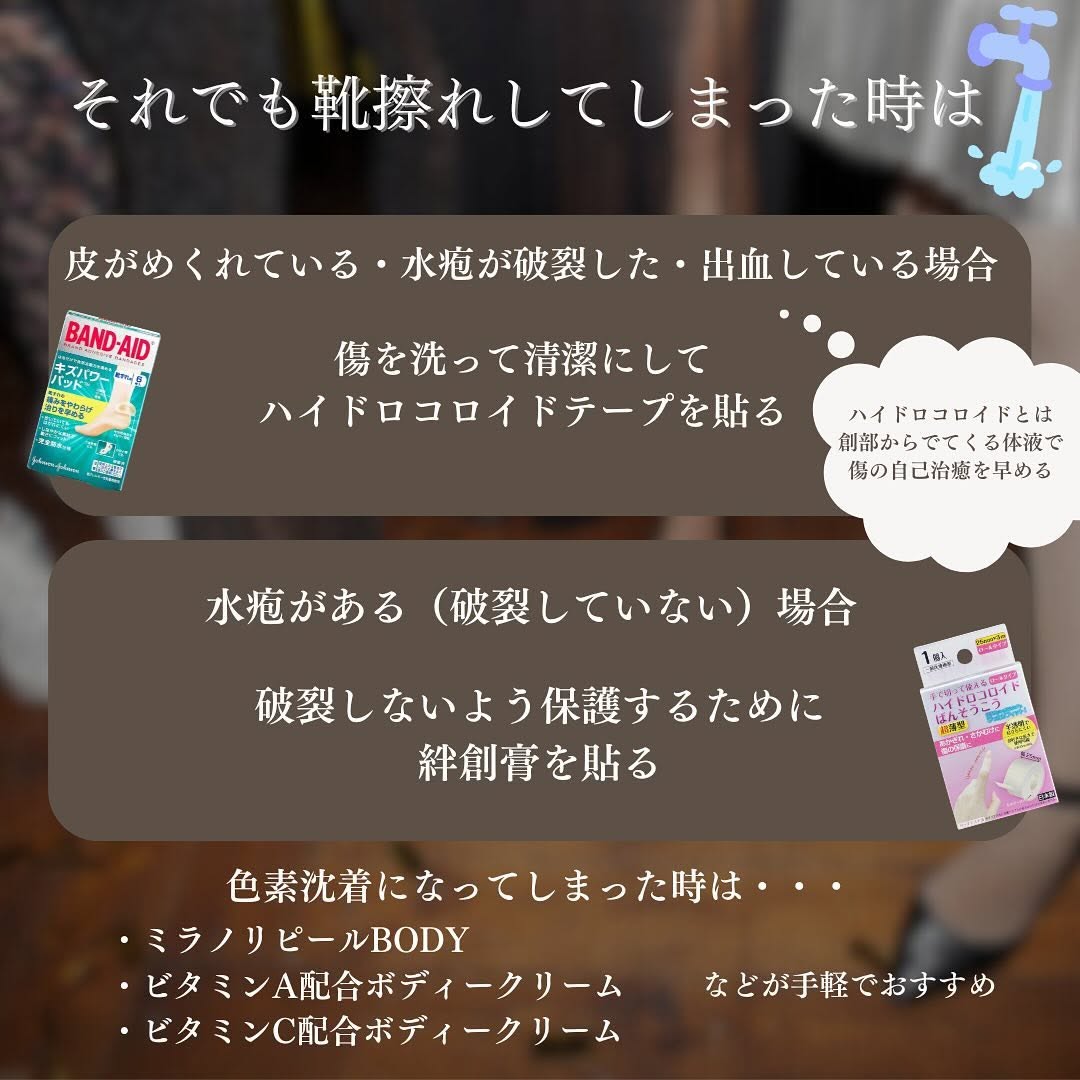 夏のおしゃれの大敵！靴擦れ防止アイテムとケア方法まとめ 画像3