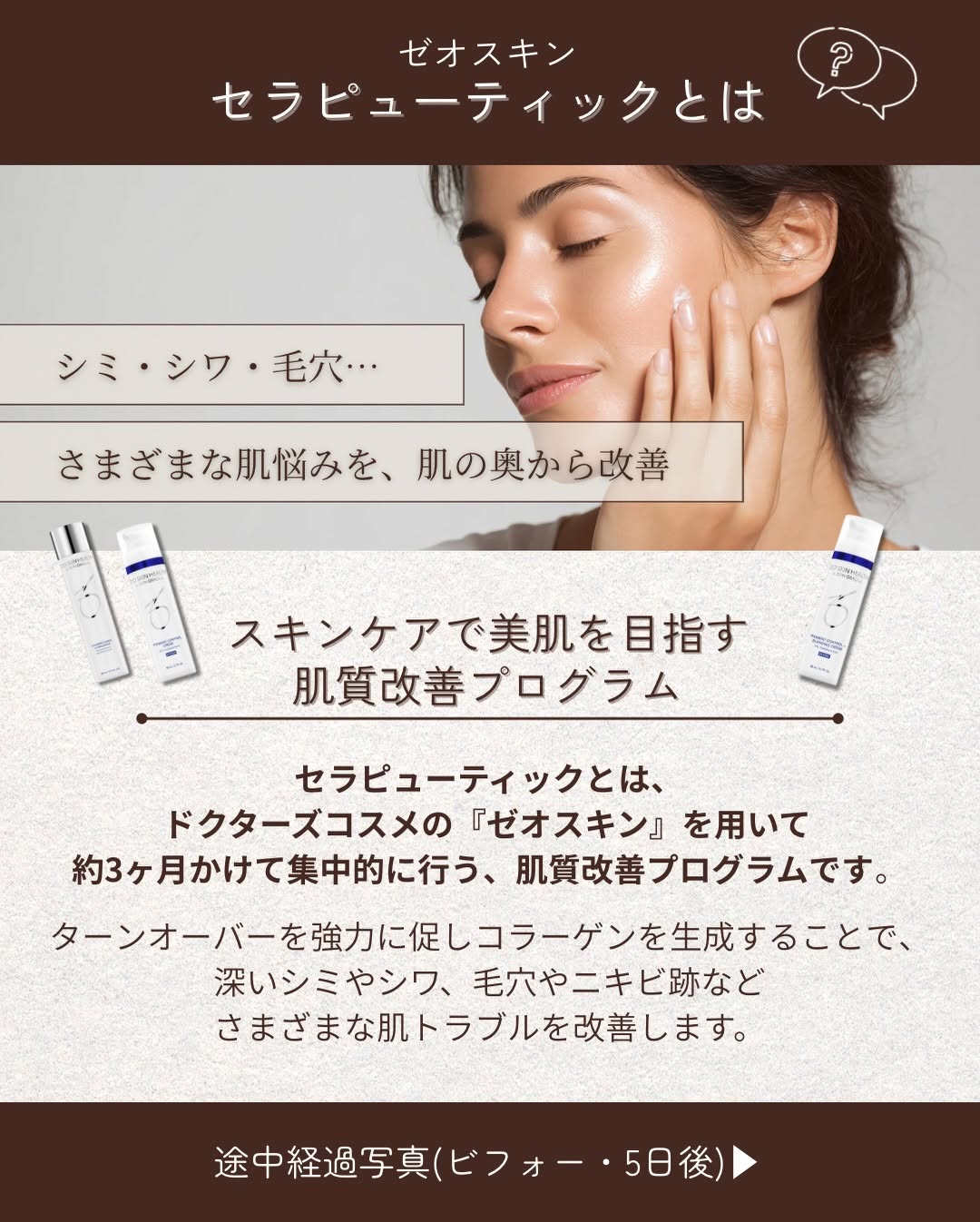 ゼオスキン セラピューティックとは｜約3ヶ月の集中肌質改善プログラムとスタッフ実体験1ヶ月レポート 画像2