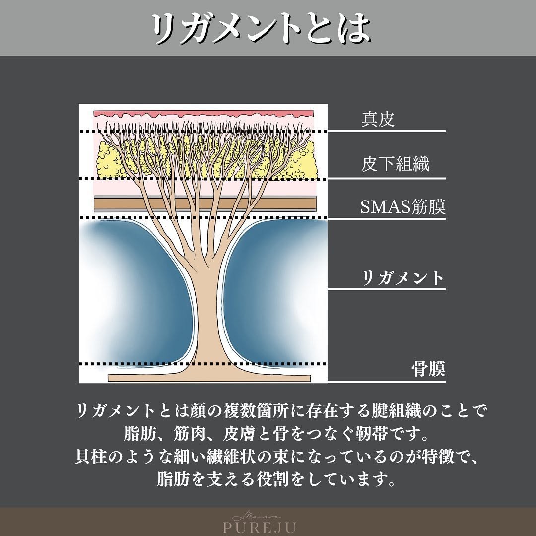 ジャルプロスーパーハイドロとは｜リガメントを強化してたるみ・ハリを根本から改善する注入治療 画像3