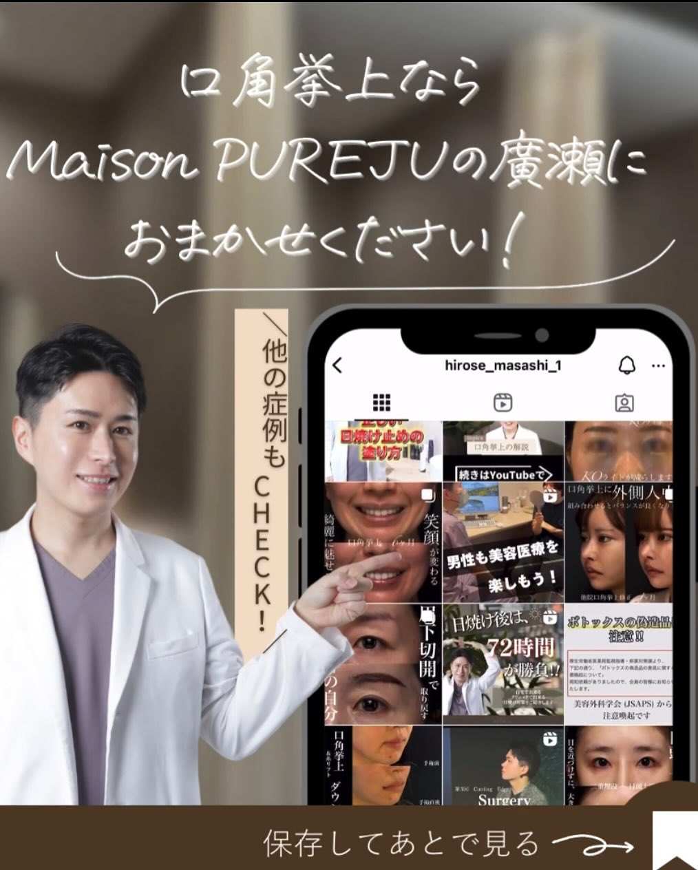 口角挙上＋ヒアルロン酸で術後6ヶ月笑顔が格段に良くなった症例 画像5