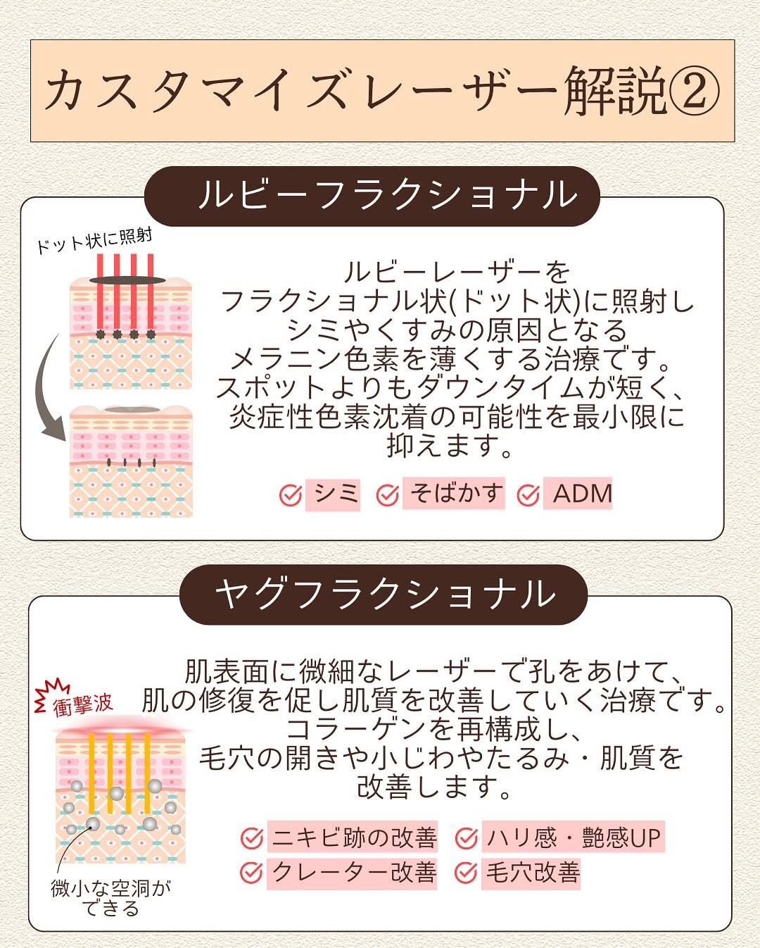 カスタマイズレーザーとは｜ジェネシス・トーニング・フラクショナルの3種組み合わせでシミ・くすみ・毛穴を一気に改善 画像4